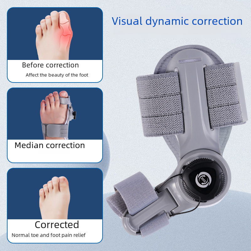 Upgraded Adjustable Bunion Corrector - HollySaleShop